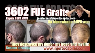 3602 Grafts. Undiagnosed BUPA repair. Depleted/BHT to donor. Rescue. 5 months 2nd HT. 2642/2021