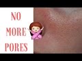 How to get rid of LARGE PORES permanently | 100% effective | Urban Panache