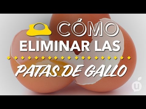 Video: ¿Qué son las patas de gallo?