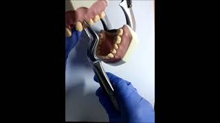 Extraction of upper remaining root #extraction
