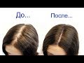 МАСКА ПРИ СИЛЬНОМ ВЫПАДЕНИИ ВОЛОС! /от ОБЛЫСЕНИЯ /ДЛЯ ГУСТЫХ ВОЛОС