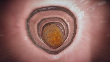 food digestion the story of how your food ends up as a poo 3d medical animation|dandelion team