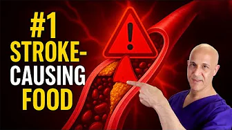 This Food Is a Stroke Ready to Happen — Stop Eating It Now!  Dr. Mandell