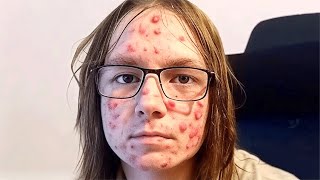 The TikToker Who Refuses To Shower