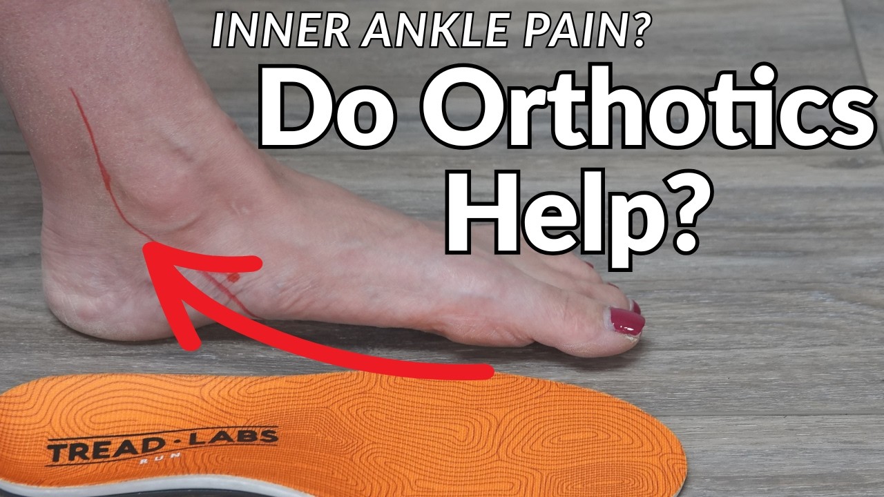 Боль во внутренней части голеностопного сустава? Тендинит задней большеберцовой мышцы и ортопедич...