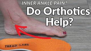 Inner Ankle Pain? Tibialis Posterior Tendonitis & Orthotics Explained