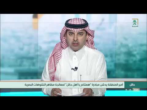 رئيس بلدية وسط حائل في حديث عن مبادرة همتكم يا أهل حائل لمعالجة مظاهر التشوهات البصرية