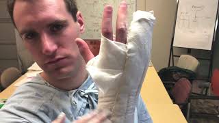 Ulnar Gutter Splint Demonstration