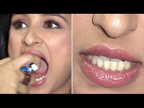 Parineeti Chopra Shows Off Her Dirty Yellow Teeth OOPS SHE DID IT AGAIN