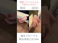 【早くも大きな変化が！】関節リウマチによる手指のこわばり　