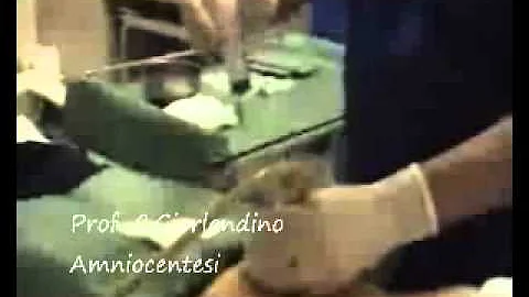 Quanti tipi di amniocentesi ci sono?