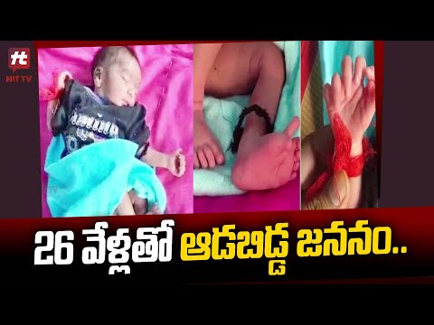 Viral News : Baby Girl Born With 26 Fingers@HitTVNewsTelugu