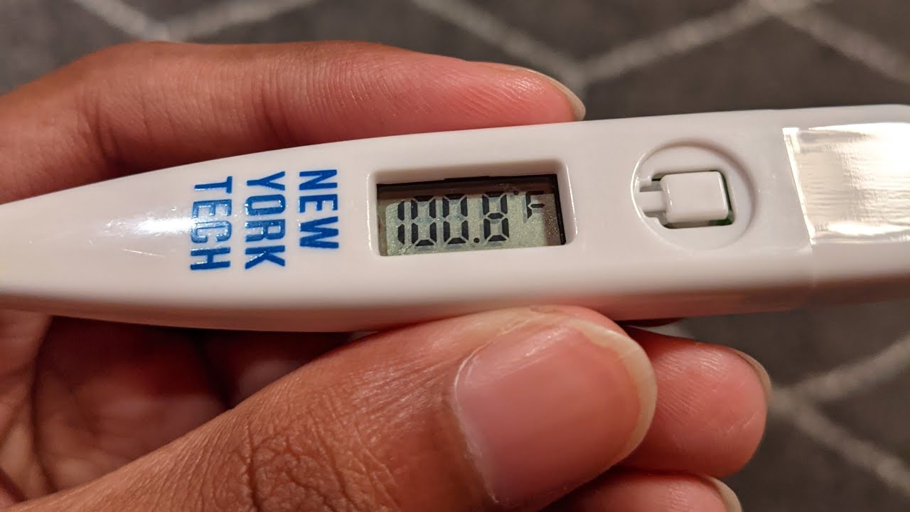 Fever over 101°F (38.3°C)