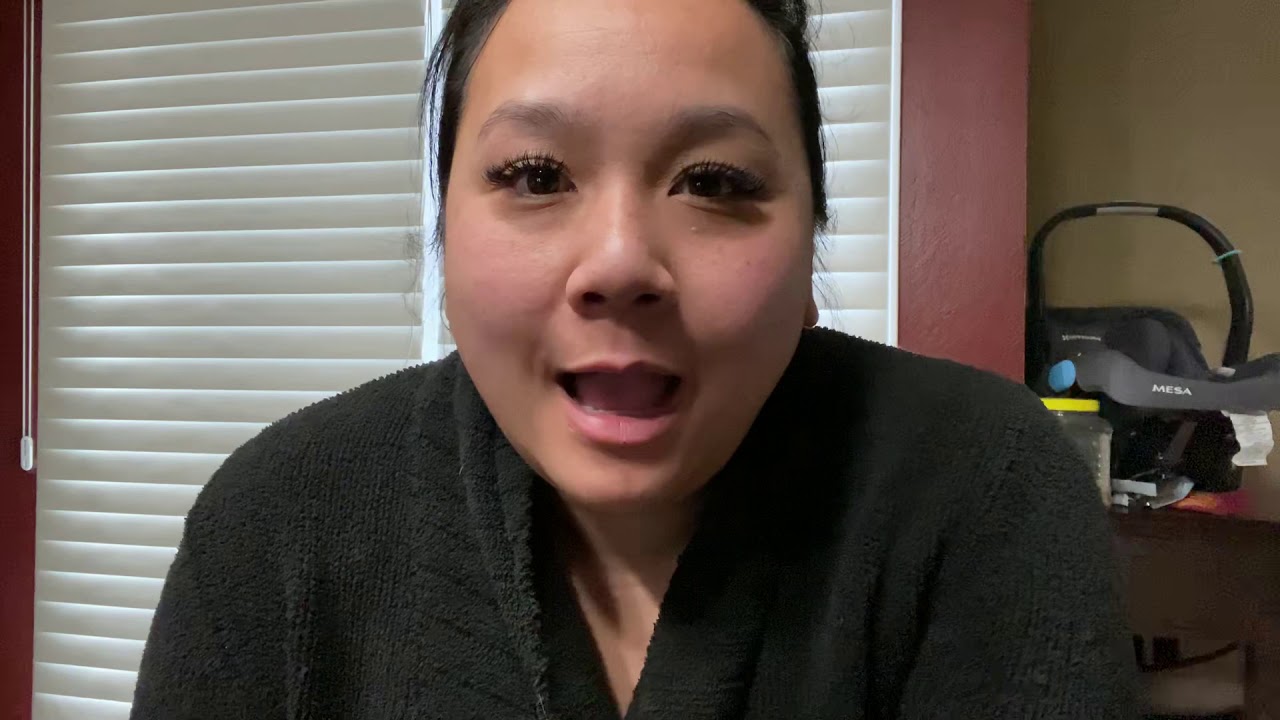 Single umbilical artery update!