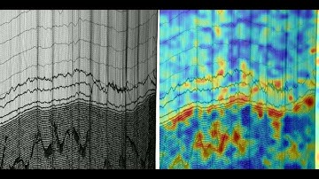 Anomaly Detection in Tire Cord Fabric using Computer Vision