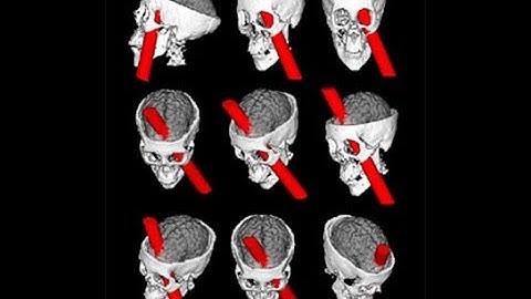 The brains of the brain: why is the prefrontal cortex involved in just about everything?