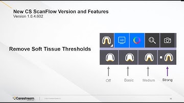 CS ScanFlow - Soft Tissue Removal Feature