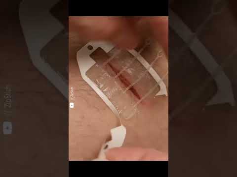 Zip Stitches #shorts