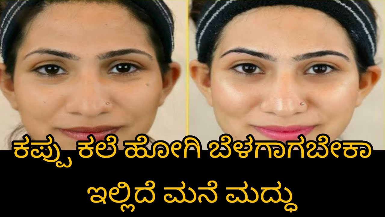 Glowling skin ಟಿಪ್ಸ್ in kannada ❤️ ಕಪ್ಪು ಕಲೆಗಳು ಹೋಗಿ ಮುಖ ಹೊಳೆಯುತದೇ ❤️   