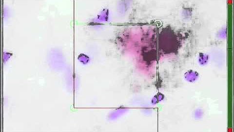 Stereologer Optical Fractionator (total cell number)