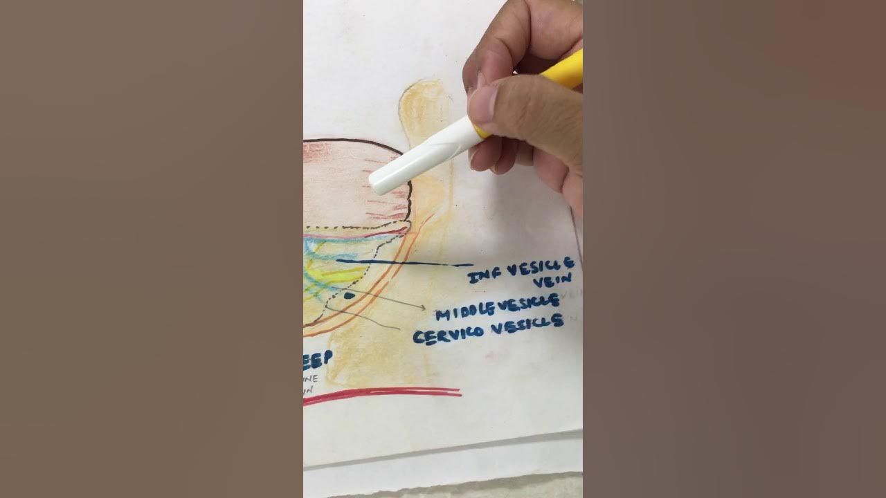 The deeper and theoretical anatomy of the bladder pillar by Dr Pankhuri