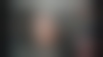 Brain Tumor - Augmented reality Surgery with BrainLab