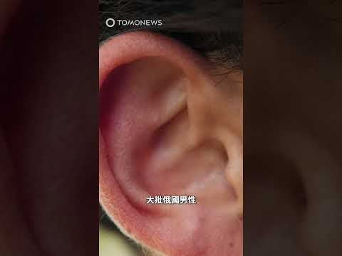 俄男瘋整形出「花椰菜耳」🥦👂 功用：威嚇其他男性 #俄國#花椰菜耳#柔道耳#水餃耳#耳殼#醫美#美容#耳鼻喉科#耳廓假性囊腫