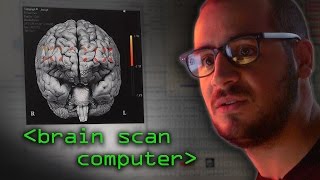 Brain Scanner - Computerphile Brain Scanner - Computerphile