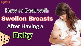 How to Deal with Swollen Breasts After Having a Baby