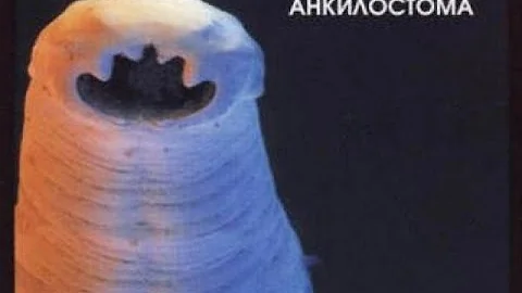 ***Глисты Анкилостома***|***Glisty Ankilostoma***