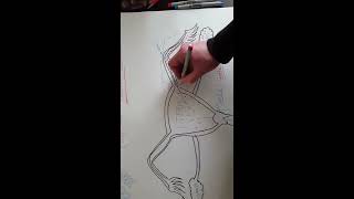 EMT Ectopic Pregnancy / EMT MADE EASY