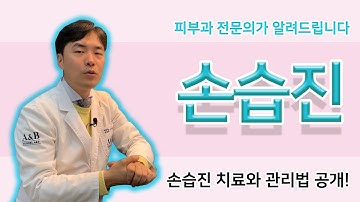 손습진 치료법 도대체 뭘까요??? / 손습진의 다양한 원인과 해결법 / 연세에이앤비피부과 이해진원장