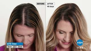 XcelleratePlus Hair Serum and Minoxidil 2%