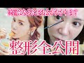 【美容整形】アラフォー女子の高額整形費用と整形全部公開します