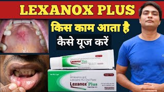 lexanox plus | lexanox plus gel uses in hindi | lexanox plus uses in hindi