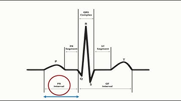 Corrected QT interval (QTc) calculation with Bazett
