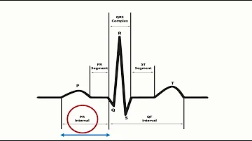 Cosa significa ECG con QTc?