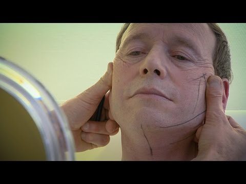 Video: Männliche Schönheit: Prominente Männer, Die Sich Einer Plastischen Operation Unterzogen Haben