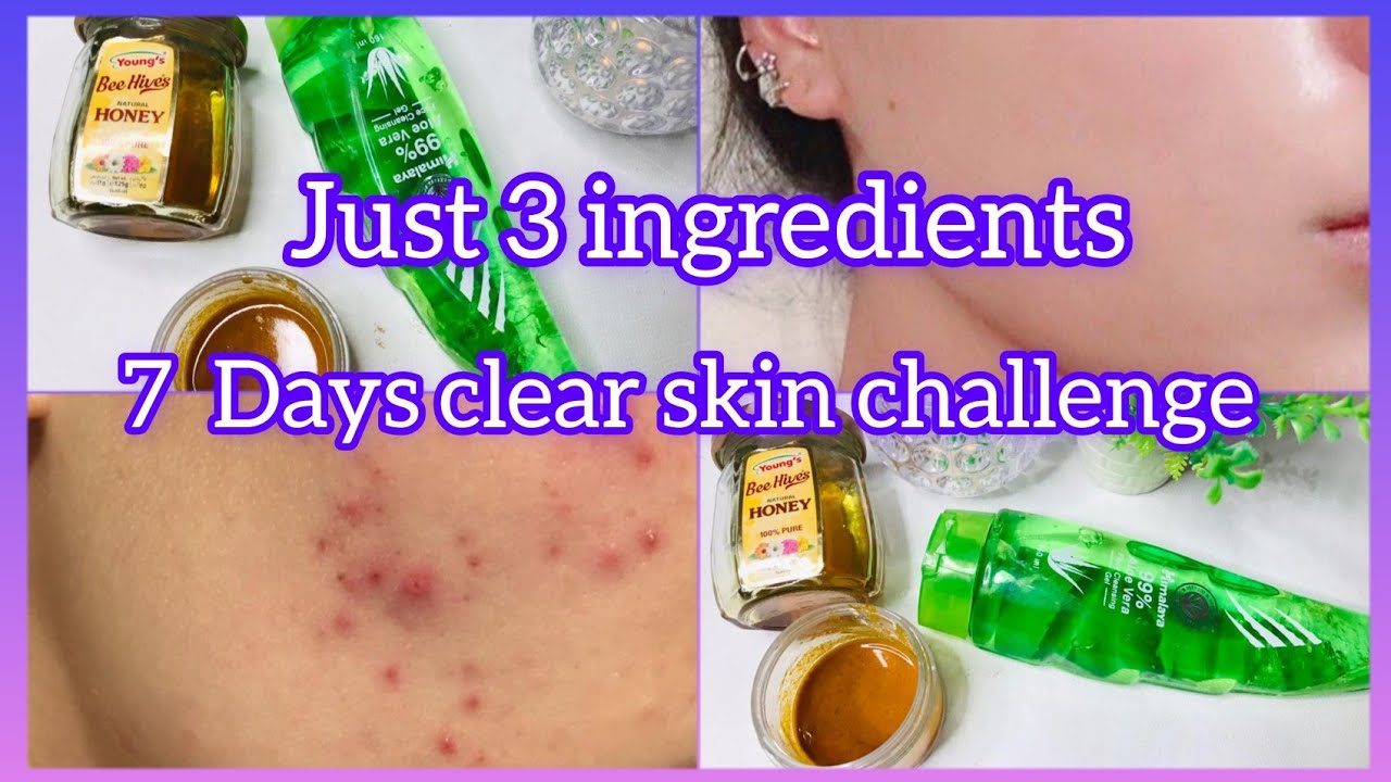 7 Days clear skin challenge | Get rid of textured skin arnd uneven skin ...