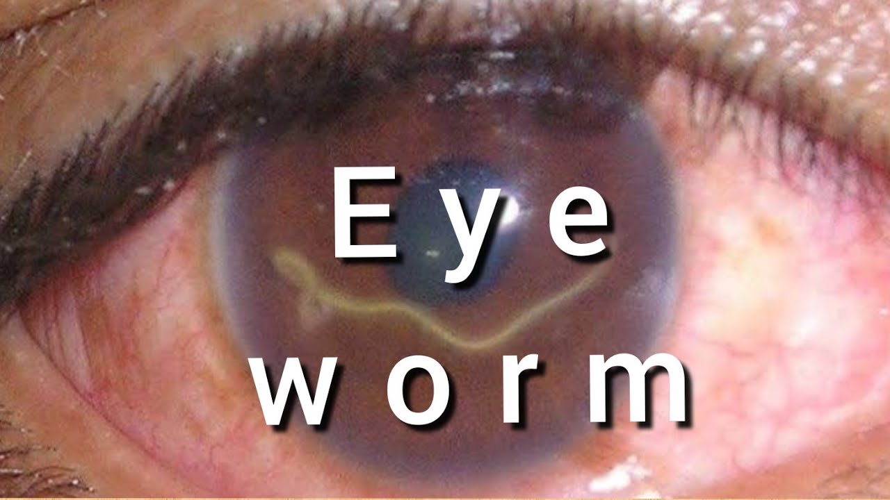 EYE #WORM 