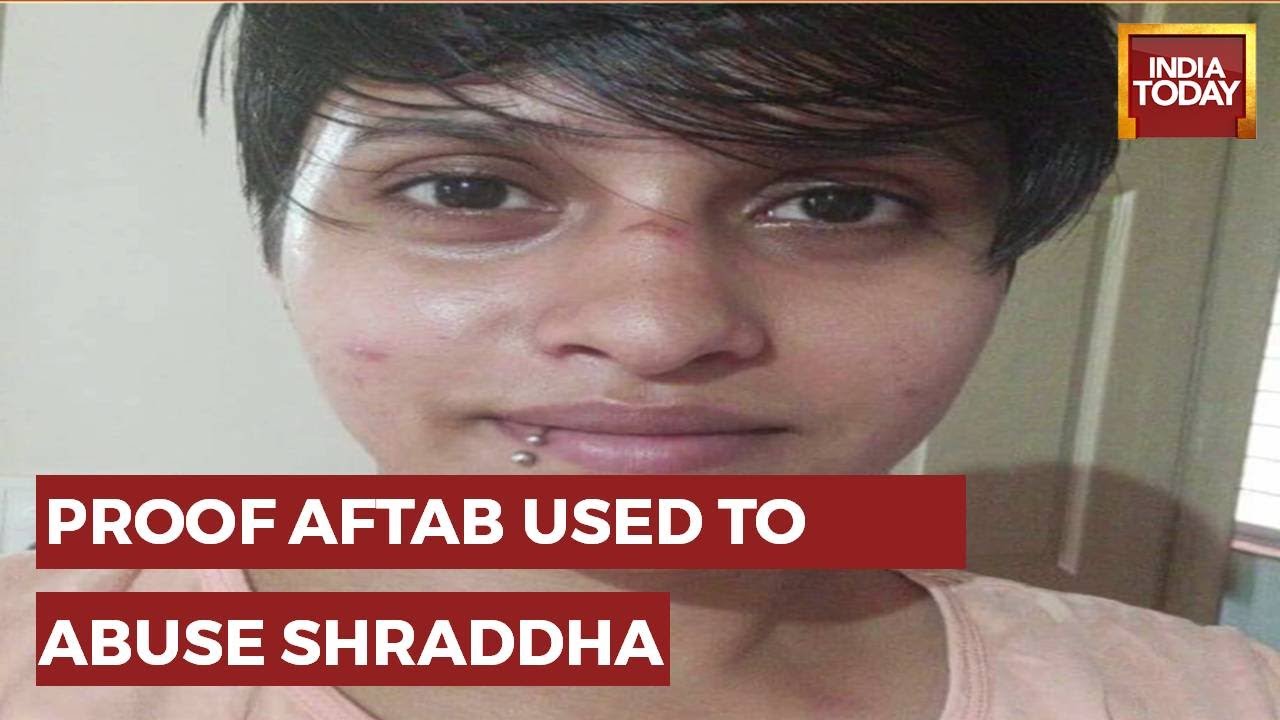 'Eyes Swollen, Nose & Cheek Scratched' 2020 Image Of Injured Shraddha