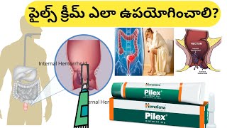 How to Use Piles Ointment in Telugu