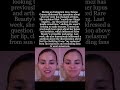 Selena Gomez Opens Up About Vocal Changes &amp; Melasma in Candid Instagram Live #SelenaGomez #viral