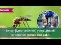 Penyebab Kaki Gajah dan Ciri Cirinya - Yuk Kenali dan Cegah Penyebab Kaki Gajah (Filariasis)