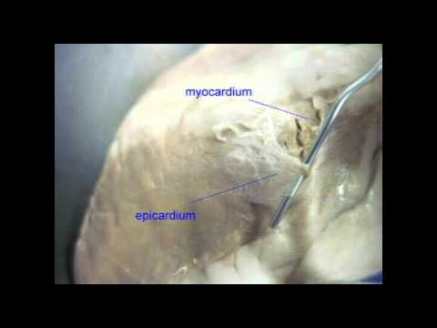 AP2 EXAM 1: HEART: EPICARDIUM.avi - YouTube