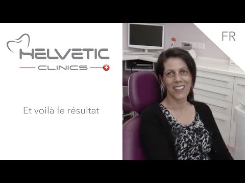 Facettes Dentaires - Témoignage Helvetic Clinics, clinique dentaire et dentistes en Hongrie