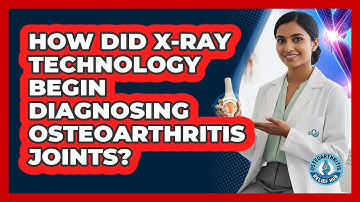How Did X-ray Technology Begin Diagnosing Osteoarthritis Joints? - Osteoarthritis Relief Hub
