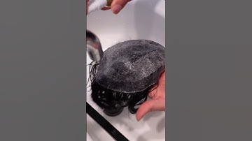 Pro Tips: Safely Remove Tapes from Your Skin Base Hair System Without Damage!  #hairlosssolution