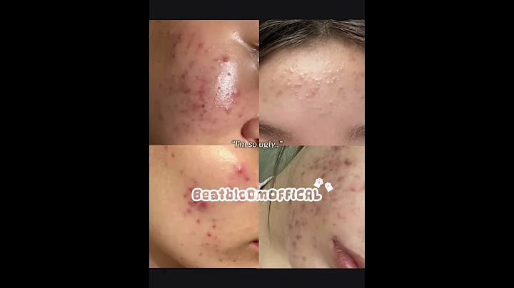 Right my baddies?! #aesthetic #skincare #helpmemakethismakesense #amnewbutnottheleast