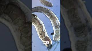 Famous tap water under microscope Net Worth
